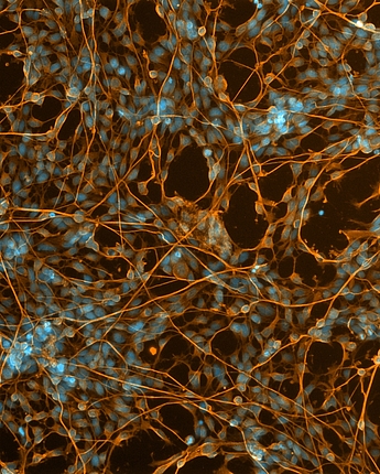 FerroNeuron - Ferroptose in dopaminergen Neuronen